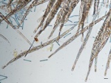 Tolypocladium longisegmentatum image