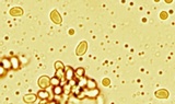 Tricholoma saponaceum image