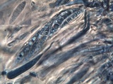 Bilimbia sabuletorum image