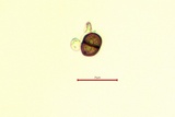Cyphelium tigillare image