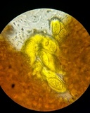 Phyllactinia guttata image
