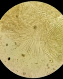 Vibrissea filisporia image