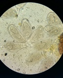 Golovinomyces cichoracearum image