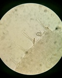 Pezoloma marchantiae image