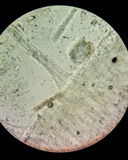 Pezoloma marchantiae image