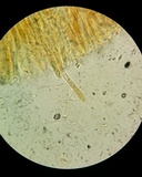 Pezoloma marchantiae image