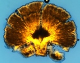 Hymenoscyphus calyculus image