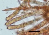 Hymenoscyphus calyculus image