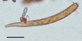 Hymenoscyphus calyculus image