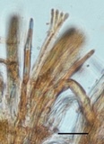 Hymenoscyphus calyculus image