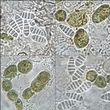 Arthonia pruinata image