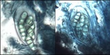 Arthonia calcarea image