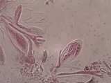 Collema tenax var. tenax image