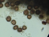 Scleroderma albidum image