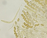 Pseudombrophila cervaria image