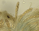 Ascobolus stercorarius image
