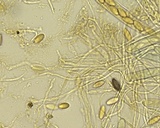 Ascobolus stercorarius image
