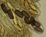 Ascobolus stercorarius image