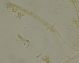 Cheilymenia stercorea image
