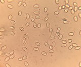 Amanita pseudovolvata image