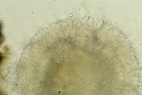 Arachnopeziza aranea image