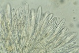 Arachnopeziza aranea image
