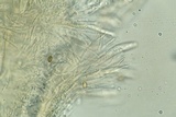 Arachnopeziza aranea image