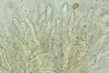 Arachnopeziza aranea image