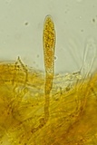 Arachnopeziza aranea image