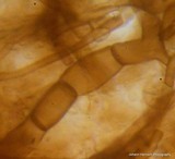 Rhizopogon brunneiniger image