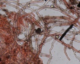 Ascorhizoctonia praecox image