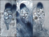Caloplaca pyracea image
