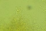 Abortiporus biennis image