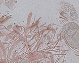 Peziza ripensis image