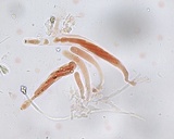 Lasiosphaeria ovina image