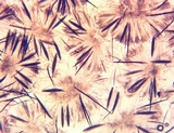 Trichoglossum hirsutum image