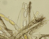 Plectania nannfeldtii image