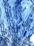 Clauzadea immersa image