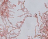 Peniophora aurantiaca image