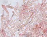 Peniophora aurantiaca image