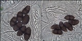 Rinodina beccariana image