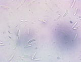 Chlorencoelia versiformis image