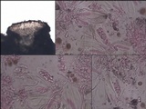 Lecania turicensis image