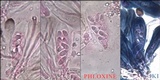 Lecania turicensis image