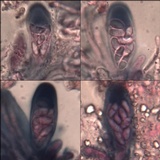 Lecania turicensis image