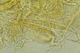 Lasiosphaeria lanuginosa image