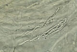 Lasiosphaeria lanuginosa image