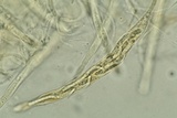 Lasiosphaeria lanuginosa image