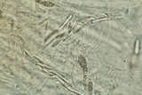 Lasiosphaeria lanuginosa image