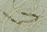 Lasiosphaeria lanuginosa image